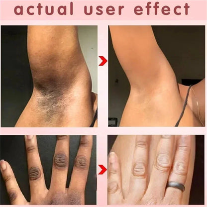 Crema blanqueadora para partes íntimas, suero blanqueador de axilas, blanquea glúteos y rodillas, aclara la parte interna del muslo, oscurece las partes íntimas y elimina la melanina.