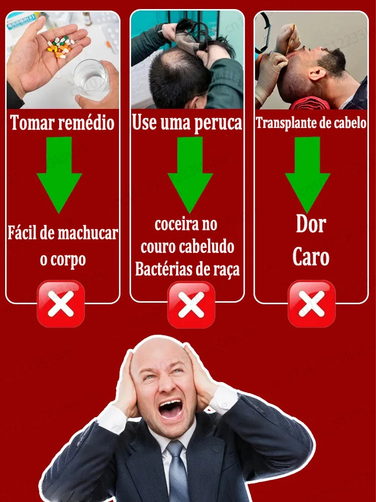 Este é absolutamente o produto para crescimento capilar mais eficaz do século XXI, que ajudou milhões de pessoas a se livrar da queda de cabelo e da calvície, 100% eficaz.