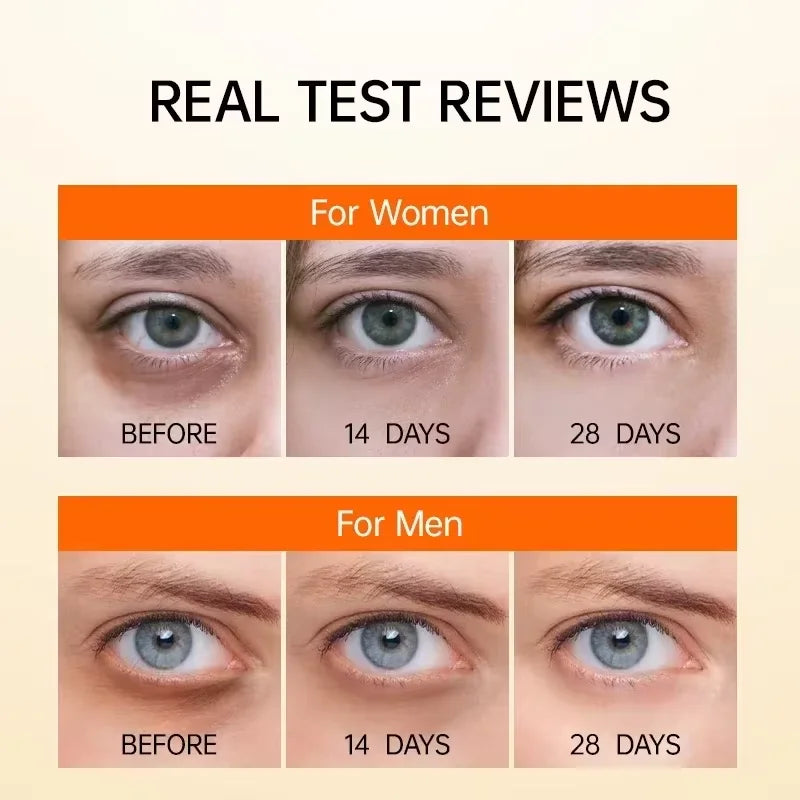Suero de ojos antiojeras con retinol, antiarrugas, reafirmante, elimina bolsas, atenúa líneas finas, blanquea e ilumina. Cuidado de ojos coreano.