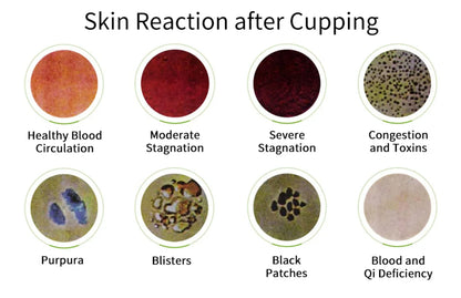 12Pcs Vacuum Cupping Sets with Pumping Gun Suction Cups Back Massage Body Cup Detox Anti Cellulite Cans Healthy Care Jars