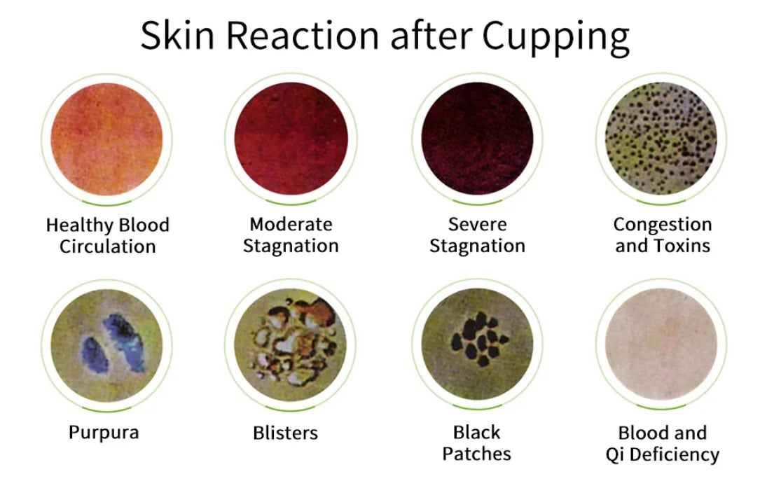 12Pcs Vacuum Cupping Sets with Pumping Gun Suction Cups Back Massage Body Cup Detox Anti Cellulite Cans Healthy Care Jars