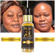 AILKE 24K Gold Flawlessly Skin Care Set, Whitening, Reduces Dark Spots, Pigmentation, Wrinkles, Moisturizes, For All Skin Types