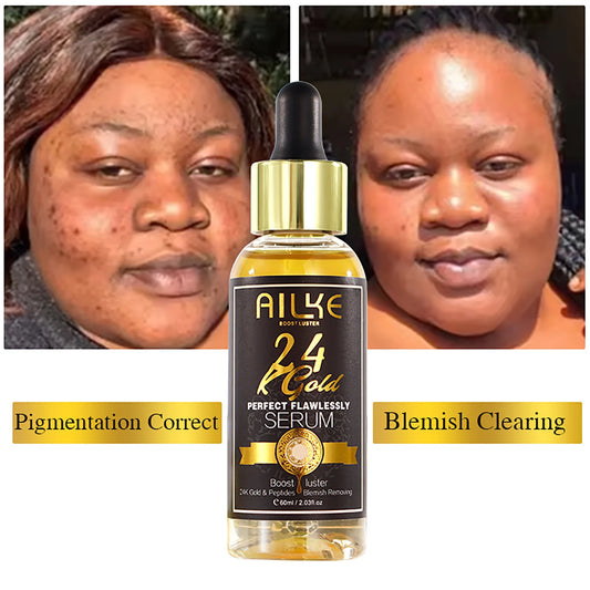 AILKE 24K Gold Flawlessly Skin Care Set, Whitening, Reduces Dark Spots, Pigmentation, Wrinkles, Moisturizes, For All Skin Types