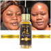 1 bottle serum