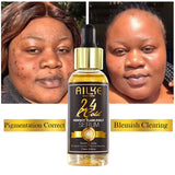 AILKE 24K Gold Flawlessly Skin Care Set, Whitening, Reduces Dark Spots, Pigmentation, Wrinkles, Moisturizes, For All Skin Types