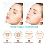30pcs Acne Pimple Patches Invisible Removal Pimple Anti-Acne Hydrocolloid Patches Spots Mark Concealer Waterproof Repair Sticker