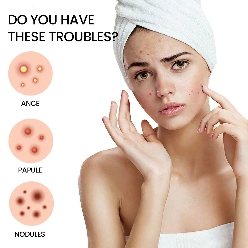 200pcs Colorful Star-Shaped Hydrocolloid Invisible Pimple Patches For Face, Cute Zit Cover Stickers Skin Care