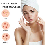 200pcs Colorful Star-Shaped Hydrocolloid Invisible Pimple Patches For Face, Cute Zit Cover Stickers Skin Care