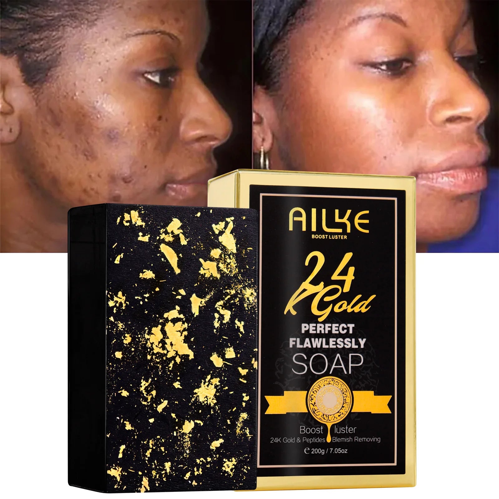 AILKE 24K Gold Flawlessly Skin Care Set, Whitening, Reduces Dark Spots, Pigmentation, Wrinkles, Moisturizes, For All Skin Types