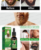 The most effective beard growth essence in 2025, grow a thick beard in 7 days. Chest hair, leg hair, beard and hair growth