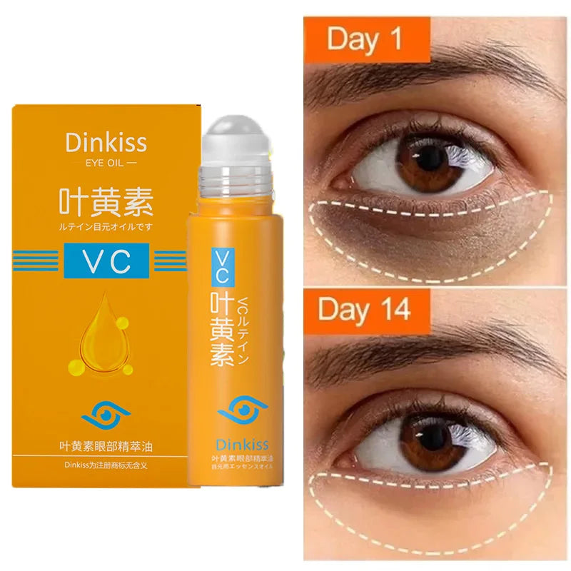 Anti Dark Circle Eye Serum Oil Retinol Anti Wrinkle Firming Skin Remove Eye Bag Fade Fine Line Whitening Brighten Eye Care Korea