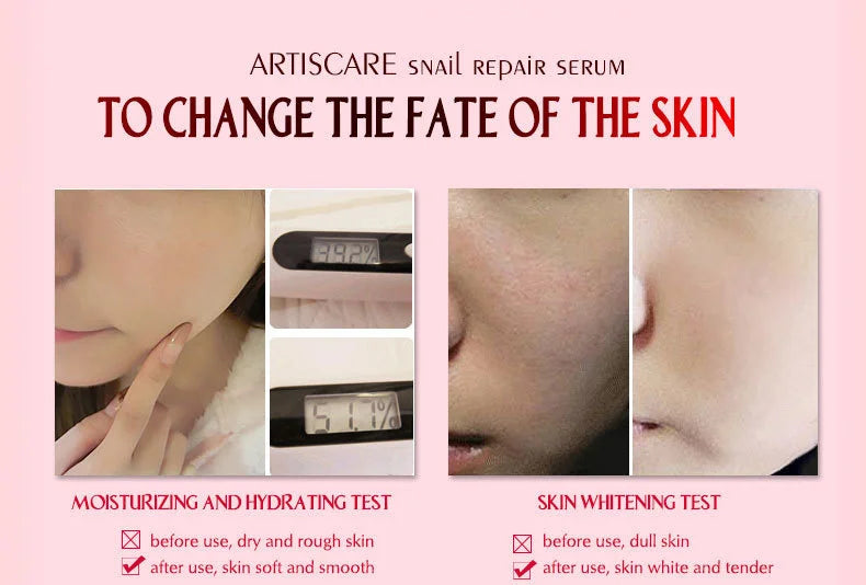 ARTISCARE Snail Essence 3pcs for Moisturizing and Nourishing Face Serum Skin Care Cream