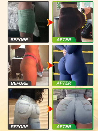 30ML West Africa Buttock Exercise Butt Enlargement Oil Breast Enhancement Hips Enlarge Hip Fat Cells Get Bigger Butt By Walking
