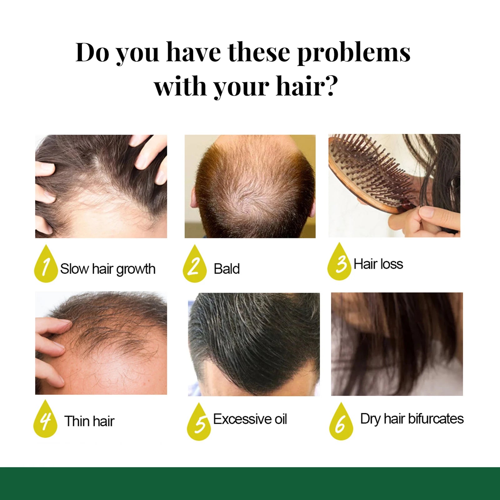 Ginger Hair Growth Serum Sprayer Fast Hair Growth Dense Regrowth Ginger Serum Oil Natural Hair Growth Accelerator For Stronger