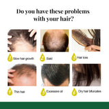 Ginger Hair Growth Serum Sprayer Fast Hair Growth Dense Regrowth Ginger Serum Oil Natural Hair Growth Accelerator For Stronger