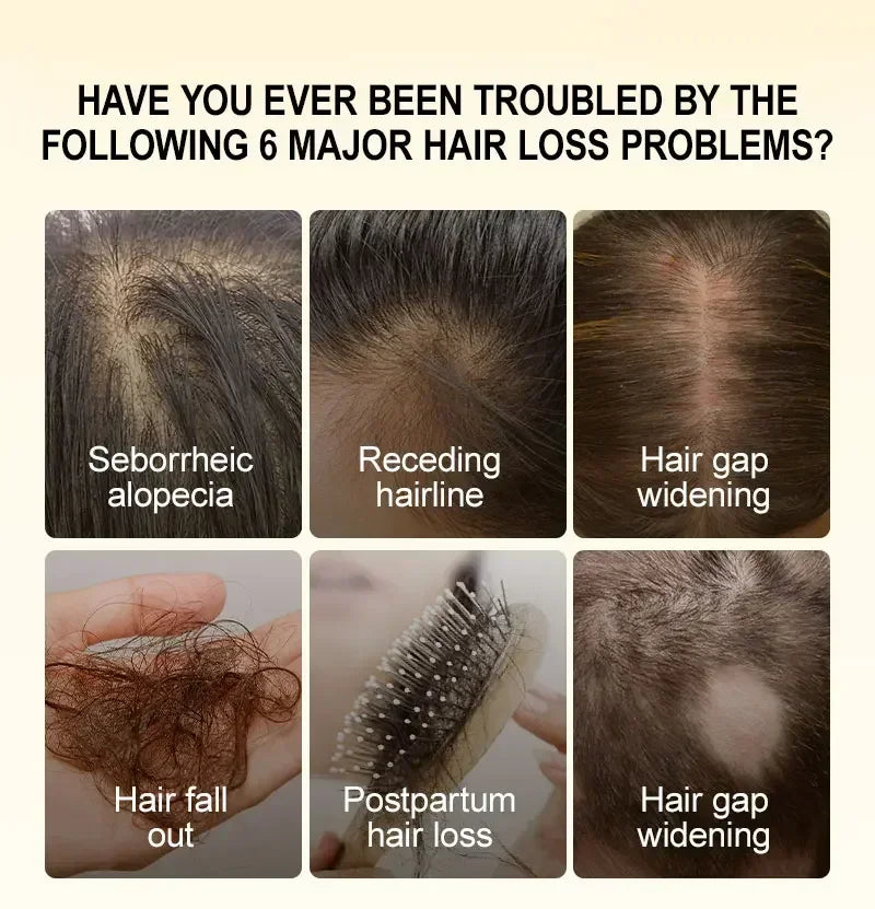 Fast Hair Growth for Men and Women, Ginger Hair Growth Oil, Hair Care, Anti-Hair Loss Treatment, Scalp Serum, Beauty and Health Products