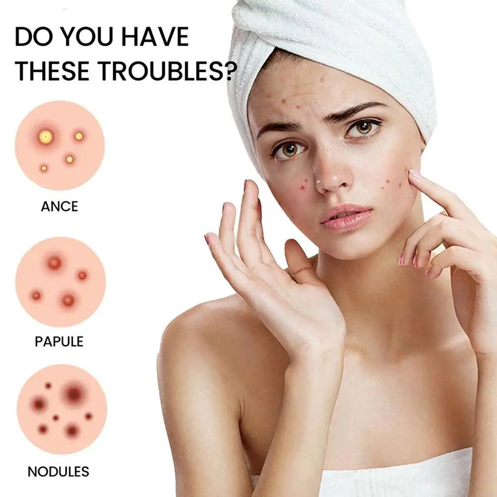 216PCS Pimple Patch Acne Colorful Invisible Acne Removal Skin Care Stickers Concealer Face Spot Beauty Makeup Tools