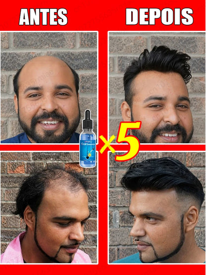 Este es absolutamente el producto para el crecimiento del cabello más eficaz del siglo XXI que ha ayudado a millones de personas a deshacerse de la pérdida del cabello y la calvicie, 100% efectivo.