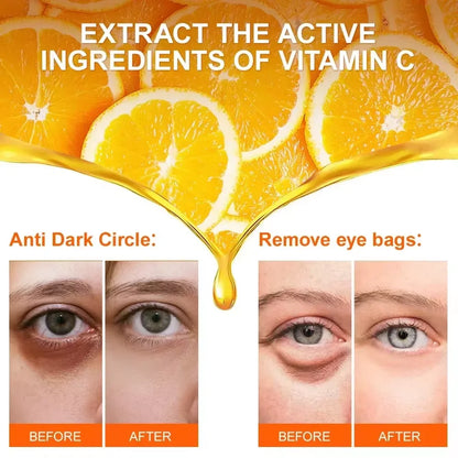 Suero de ojos antiojeras con retinol, antiarrugas, reafirmante, elimina bolsas, atenúa líneas finas, blanquea e ilumina. Cuidado de ojos coreano.
