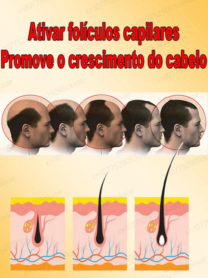 Este es absolutamente el producto para el crecimiento del cabello más eficaz del siglo XXI que ha ayudado a millones de personas a deshacerse de la pérdida del cabello y la calvicie, 100% efectivo.