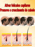 Este é absolutamente o produto para crescimento capilar mais eficaz do século XXI, que ajudou milhões de pessoas a se livrar da queda de cabelo e da calvície, 100% eficaz.