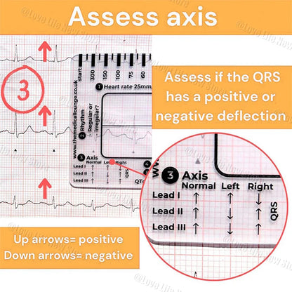 ECG 7 Step Ruler, Ruler Card for ECG/EKG Interpretation, Portable Pocket ECG EKG Reference Guide with Sheath, Emergency tool