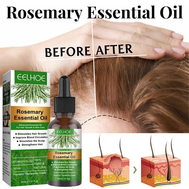 Óleo essencial de alecrim para o crescimento do cabelo, produto orgânico para o couro cabeludo, nutritivo, brilhante, saudável