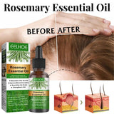 Óleo essencial de alecrim para o crescimento do cabelo, produto orgânico para o couro cabeludo, nutritivo, brilhante, saudável