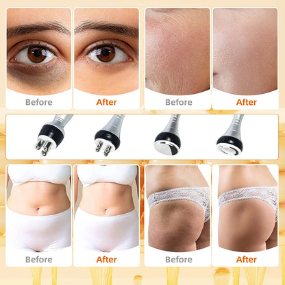Máquina de cavitación ultrasónica para adelgazamiento corporal de 4 pulgadas y 140K, dispositivo de belleza, masajeador facial, reafirmante de piel, lifting facial, succión al vacío