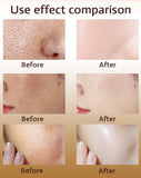 Pore Shrink Face Serum Remove Blackheads Acne Acidity Oil Control Repair Essence Moisturizing Nourish Pores Firming Facial Care