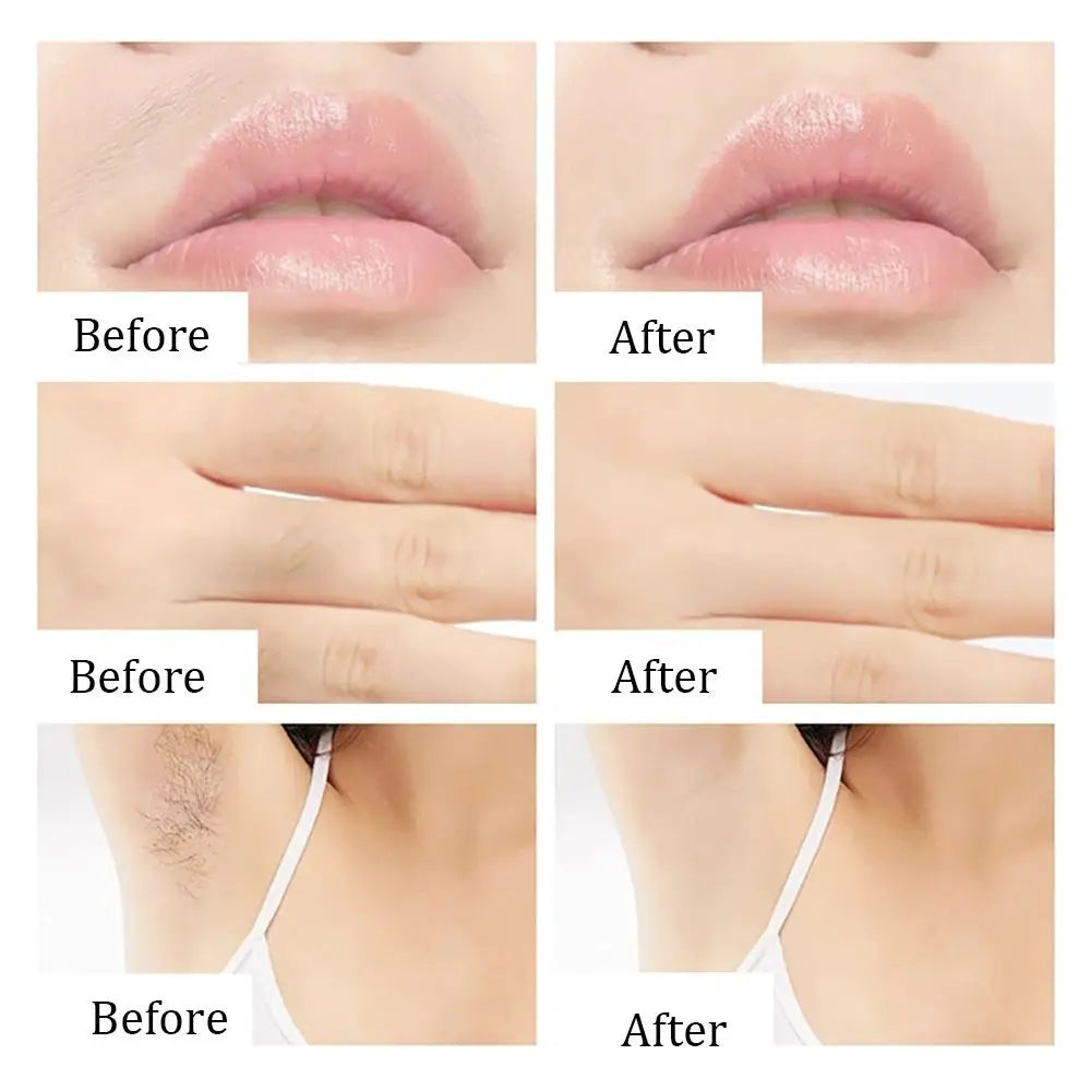 Professional Hair Removal Wax Strips for Summer Depilation Double Sided Cold Wax Paper for Leg Body Face Useful