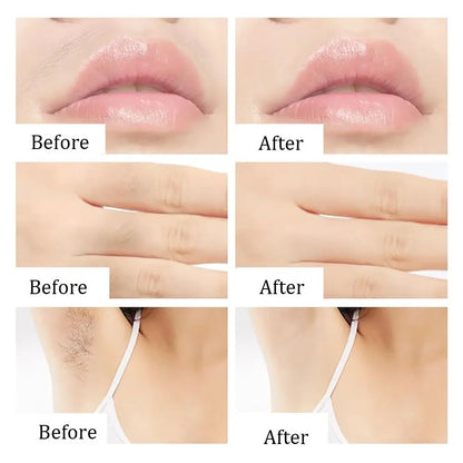 Professional Hair Removal Wax Strips for Summer Depilation Double Sided Cold Wax Paper for Leg Body Face Useful