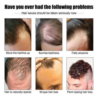 Vitamina E óleo de crescimento capilar para homens, prevenir a calvície, reparar, danificado, fortalecer raízes, melhorar a perda, reduzir o frizz, soro essencial