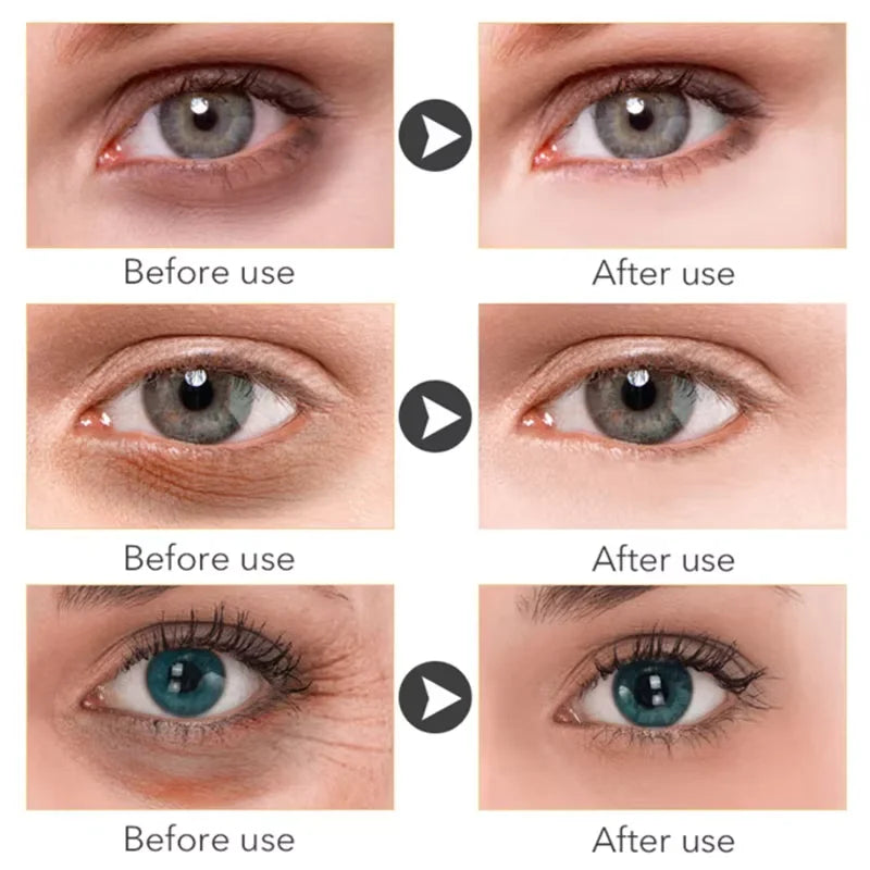 Suero de ojos antiojeras con retinol, antiarrugas, reafirmante, elimina bolsas, atenúa líneas finas, blanquea e ilumina. Cuidado de ojos coreano.
