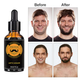 Beard Growth Kit For Men Barbe Hair Enhancerbeard Essential Oil Moisturizing Wax Growth Roller Comb Styling Scissors Beard Care