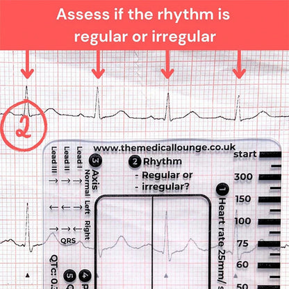 ECG 7 Step Ruler, Ruler Card for ECG/EKG Interpretation, Portable Pocket ECG EKG Reference Guide with Sheath, Emergency tool