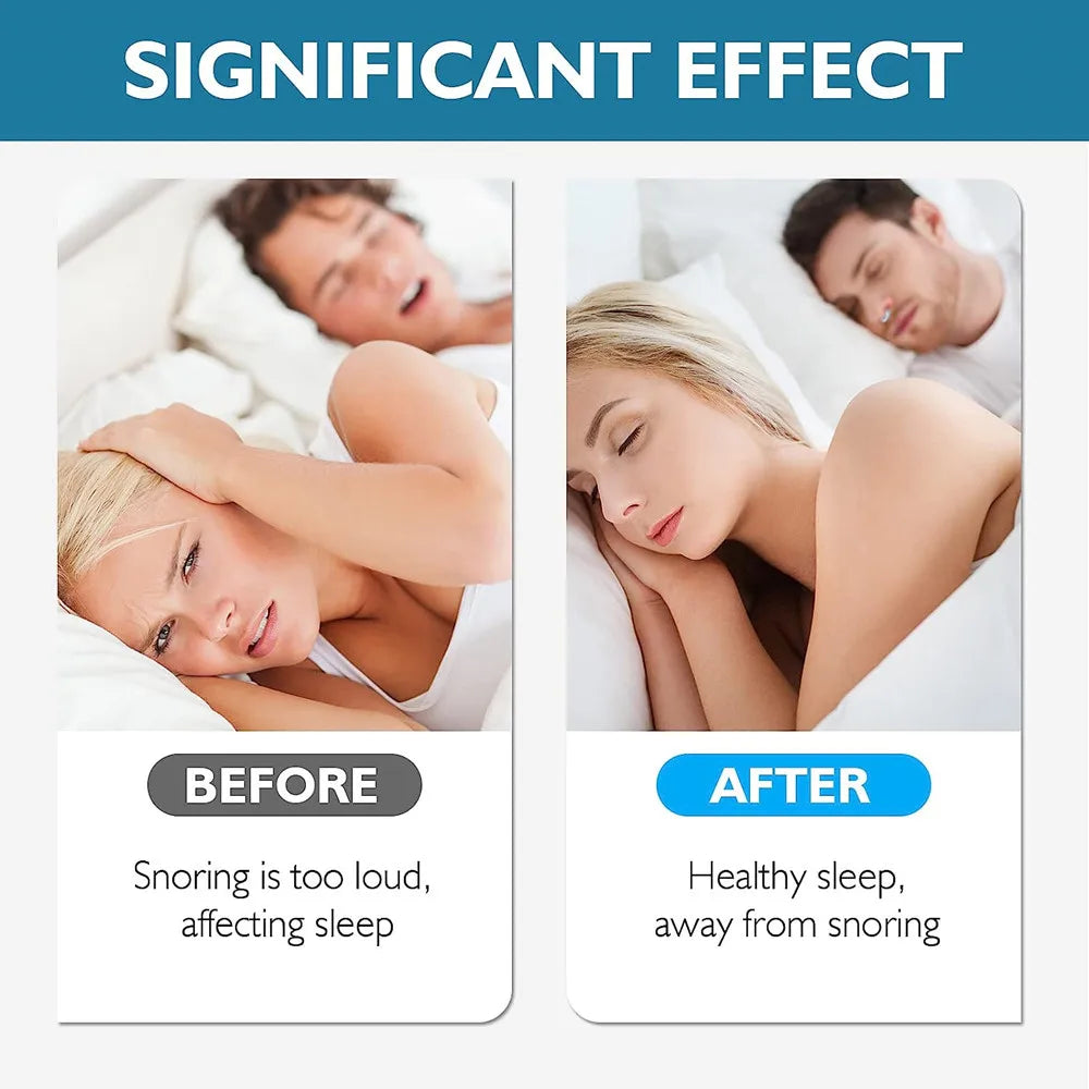 Silicone Anti Snoring Nose Clip, Anti Snoring Devices, Easy Breathing, Improve Sleep Aid, Night Apnea Device, 1-8pcs 