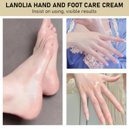 Lanolin Cream for Cracked Hands And Feet, Rich in Lanolin And Hyaluronic Acid, Deeply Moisturizes, Says Goodbye to Cracked And Dry Hands And Feet in Winter, Long-Term Use Makes The Skin of Hands And Feet Soft, Smooth, Moistur