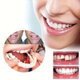 4pcs Comfortable & Flexible White Dentures with Easy-to-Wear Upper and Lower Alveolar Attachment -